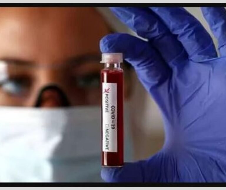 ਕੋਰੋਨਾ ਦਾ ਵੱਡਾ ਹੱਲਾ, 24 ਘੰਟਿਆਂ ਵਿੱਚ 58,097 ਨਵੇਂ ਕੇਸ, 534 ਮੌਤਾਂ