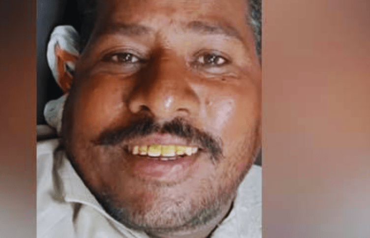 ਦੇਖੋ ਕੁਦਰਤ ਦੇ ਰੰਗ, ਸੱਪ ਨੇ ਬੰਦੇ ਨੂੰ ਡੰਗਿਆ ਤਾਂ ਸੱਪ ਹੀ ਮਰ ਗਿਆ