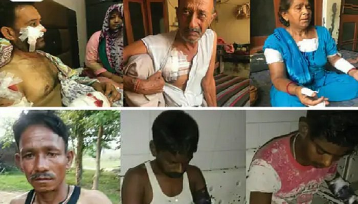 ਪਿਟਬੁੱਲ ਨੇ ਪੰਜ ਪਿੰਡਾਂ ਦੇ 12 ਲੋਕਾਂ ਤੇ ਕਈ ਪਸ਼ੂਆਂ ਨੂੰ ਹਮਲਾ ਕਰਕੇ ਕੀਤਾ ਜ਼ਖ਼ਮੀ